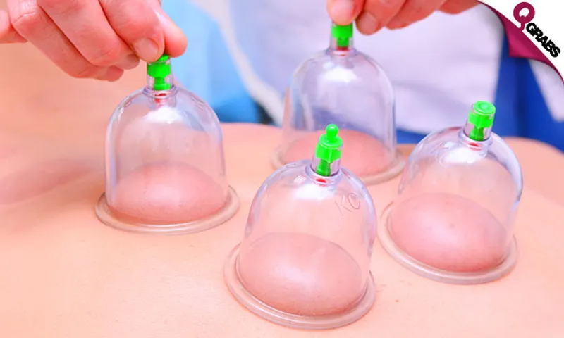 Ladies' Cupping Treatments: Gliding, Facial Massage, & Hijama at Al Hadi Medical!